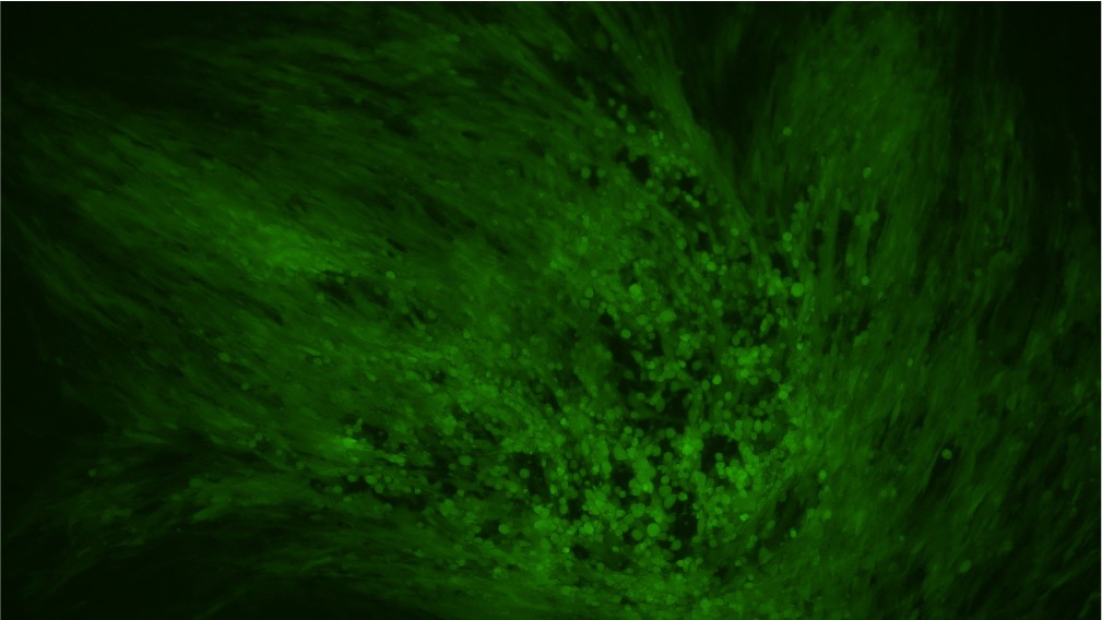 BHK-21 cells were transduced with VACV and presented strong EGFP fluorescent signal.